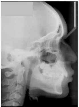 Figura 3. Radiografia Panorâmica Inicial .