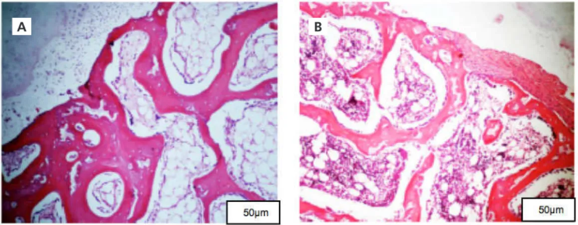 Figure 6.  A) Piezo group 28 days; B) Drill cutter group 28 days. The two groups show details of the bone trabeculae in the surgical site, evidencing mature bone tissue with  osteocytes and an osteoblastic lines.
