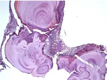 Figure 2.  Surgical specimen revealing a rectangular yellow/red piece of the upper  lip mucosa measuring 7 x 6 x 4 mm, with an irregular surface.