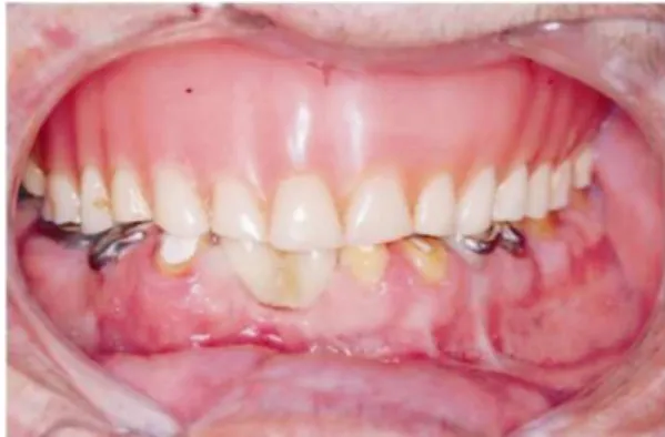 Figure 1.  Initial clinical case.