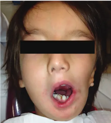 Figure 1. Photograph showing the frontal view of the patient’s face.