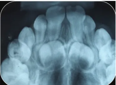 Figure 2. Photograph of the left-side of the patient’s face.