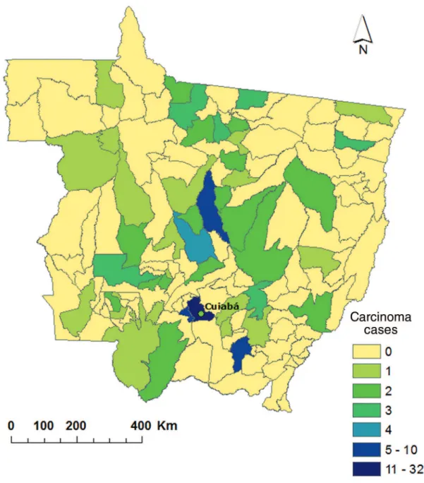 Figure 1. State Map of Mato Grosso, showing the georeferencing of epidermoid carcinoma cases diagnosed by oral lesion in a Public Laboratory in the State of Mato Grosso,  according to year of diagnosis, in the period from 2005 to 2011.