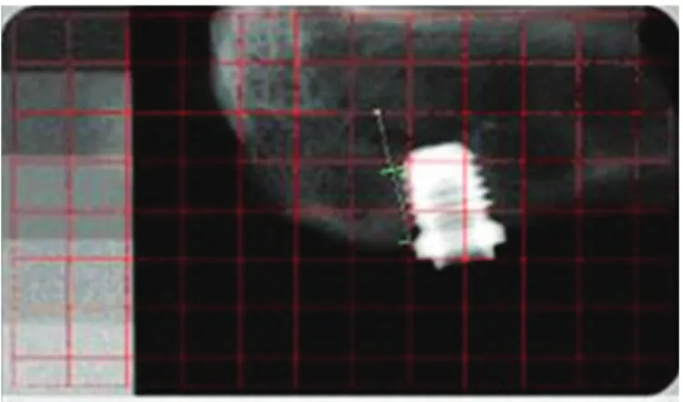 Figure 2. Optical density in the pre-determined area (green lines) using program  Pro Plus 4.5.