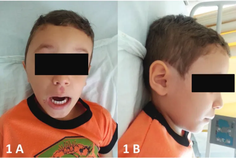 Figure 1. Appearance of patient at presentation.