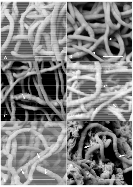 Figure 6. Scanning electron micrographs of B. cinerea mycelia after 72 hours of cultivation on Sabouraud broth with or without low and  high molecular weight chitosan at 26 o C and orbital shaking of 150 rpm