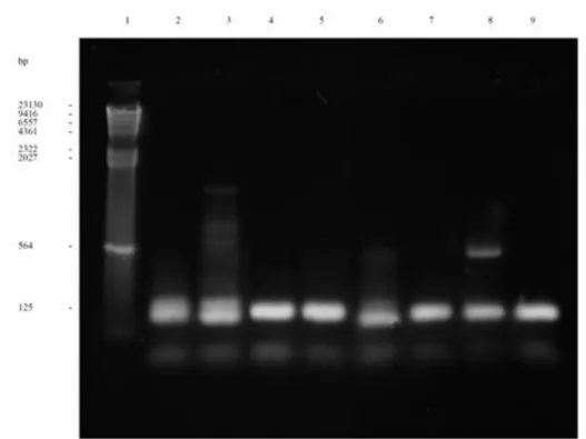 Figura  5  -  Análise  electroforética  em  gel  de  agarose  (1,5%)  corado  com  brometo  de  etídeo  dos  produtos  de  PCR  resultantes  da  amplificação  do  gene  mecA