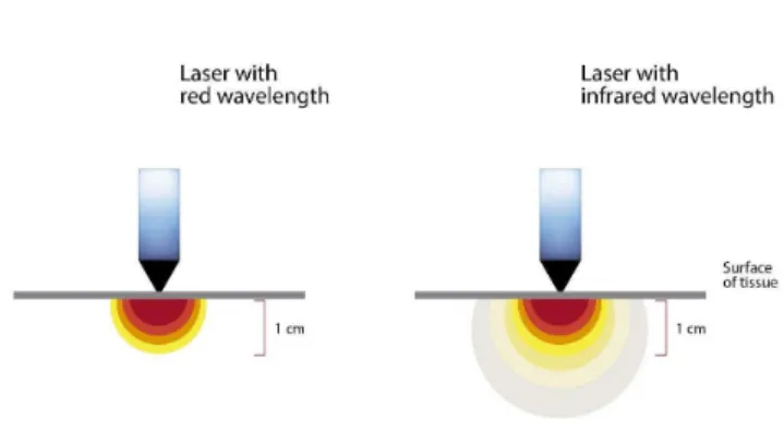Figure 2. Illustrative scheme exemplifying the penetration of the laser into the tissue  according to wavelength.