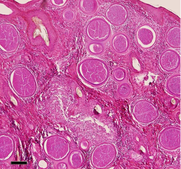 Fig. 3: Characteristic cysts of B. besnoiti, in a skin biopsy specimen from the infected bull