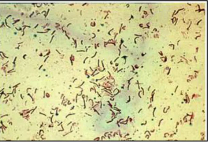 Figura  3  –  Campylobacter  jejuni  em  coloração  de  Gram. (Retirado  de:  López-Brea,  2012) 8