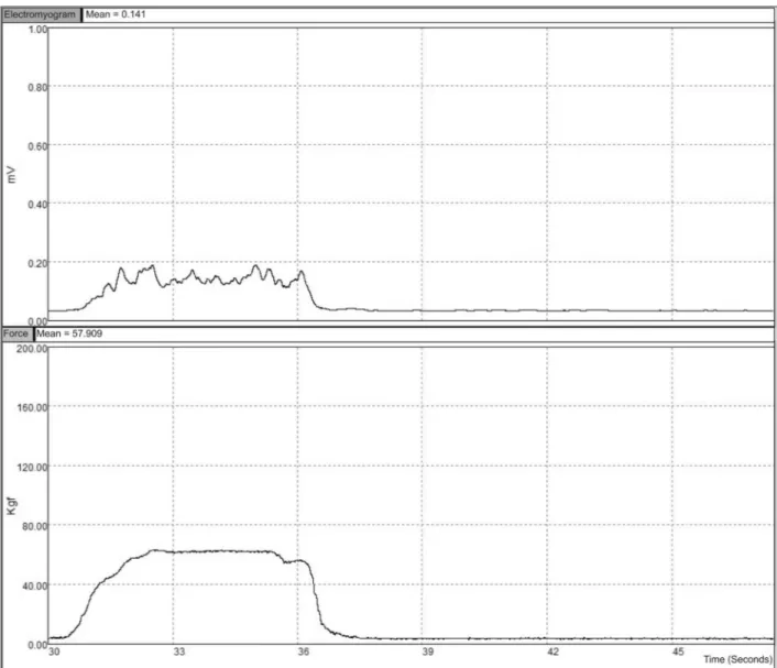 Table 1. Intragroup variation of the EMG amplitude (LPE, low-pass  envelope) and muscle force.