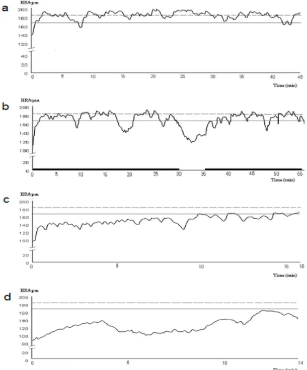 Figure 2. HR (bpm) response of a single player during several different training sessions (a