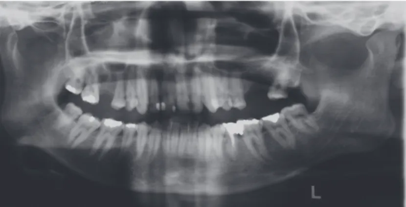 Figura 1 – Fotografias extrabucais e radiografias ao início do tratamento 