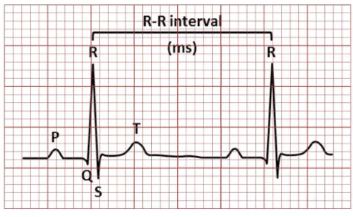 Figure 1. Overview the neural communication pathways between  baroreceptor relex and control of heart rate by autonomic nervous  system.