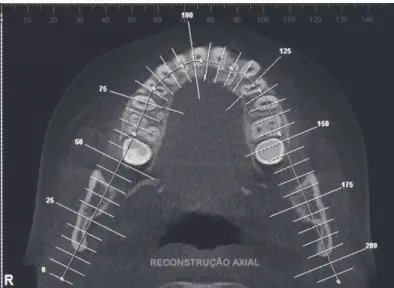 Figura 8: Visão da Posição Radicular após caso em 3D após 6 (seis) meses de   tratamento