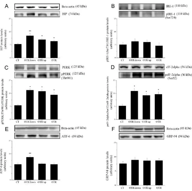 Figure 1. The responses (arbitrary units) of BIP relative to beta-actin (Figure 1A), pIRE1 (Ser734)/IRE1 (Figure 1B), pPERK (Thr981)/PERK (Figure 1C),  and peIF2alpha (Ser52)/eIF2alpha (Figure 1D); ATF-6 relative beta-actin (Figure 1E); and GRP-94 relative