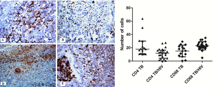 Figure 3 - Nested polymerase chain reaction. Polyacrylamide gel at 8% stained with ethidium bromide of 10 cases of the TB (a) and TB/HIV (b) group for amplification of IS6110 gene present in the genome of Mycobacterum tuberculosis (123-bp)