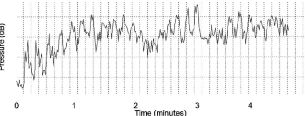 Figure 2 - Spectral sound stimulation analysis.