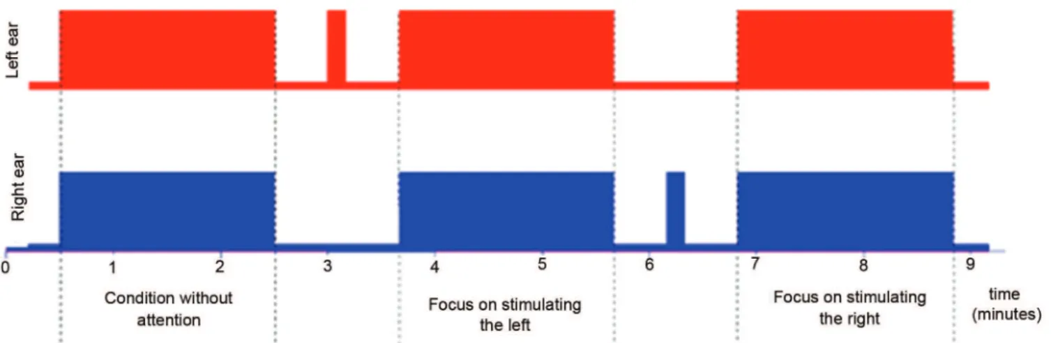 Figure 1 - Timeline to the auditory stimulus. Stimulation of the left ear (top) and right ear (bottom), with carrier frequencies of 500 Hz modulated at 32 Hz and 2000 Hz modulated  at 38 Hz, respectively.