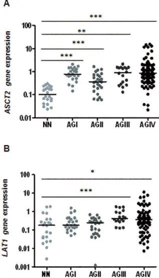 Figure 1A shows that significant  ASCT2 hyperex- hyperex-pression was observed in all grades of astrocytoma in  comparison to non-neoplastic brain tissue, and a stepwise  increment of ASCT2 expression was detected in diffusely  infiltrative astrocytomas (A