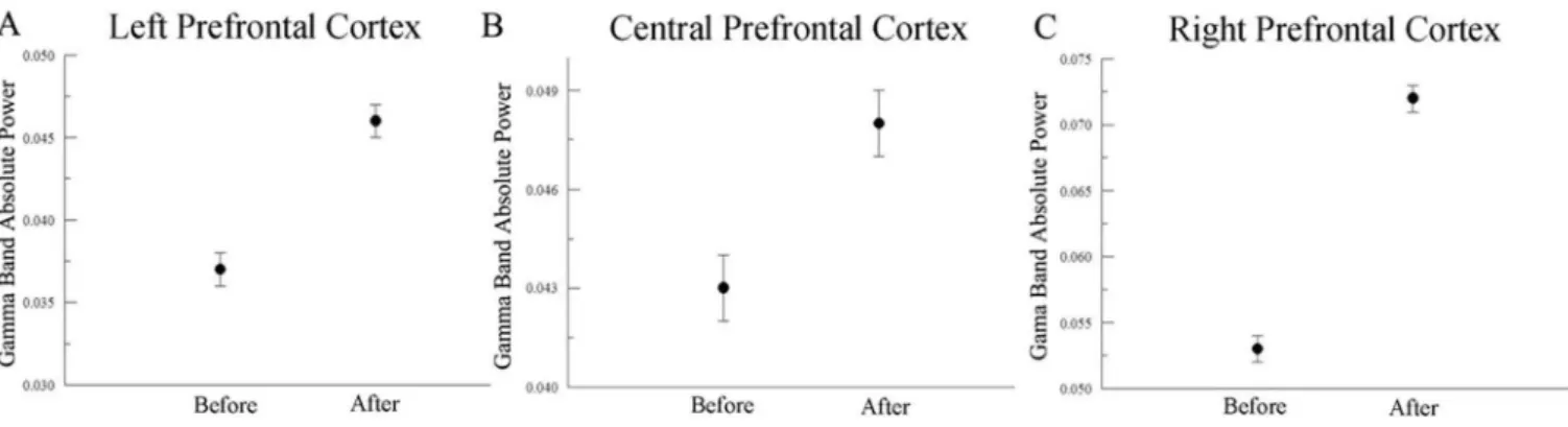 Figure 1 - Mean and SE indicate main efect for condition (before immobilization versus after immobilization) observed in (A) left prefrontal cortex (F3) (p=0.001), (B) central  prefrontal cortex (Fz) (p=0.001) and (C) right prefrontal cortex (F4) (p=0.001)