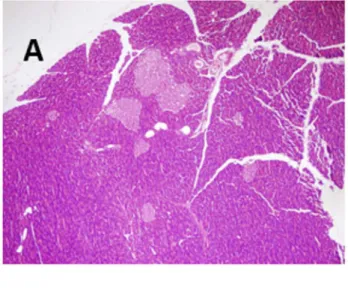 Figure 3. Histological features of pancreas tissue (HE x400): (A) normal architecture  in a normal control rat; (B) interlobular edema (arrow) in a cerulein-treated rat; (C)  perivascular neutrophil iniltration (arrow head), in a cerulein-treated rat.