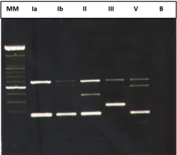 Figure 1. Gel electrophoresis of the multiplex PCR ampliication products. (Five  serotypes of six detected) In the sequence: MM –Molecular Marker of a 100 bp DNA  ladder (Invitrogen®), Lanes Ia, Ib, II, III and V – GBS serotypes, B – blank.