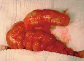 Figure 6. Partial resection of the cecum in mucocele with palpable  tumor at the base