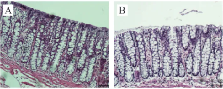 Figure 5 indicates, in average, with the respec- respec-tive standard deviation, the total tissue content of  β-catenin, comparing the control and experiment  sub-groups (with and without fecal stream) in the  differ-ent periods of fecal stream exclusion, 