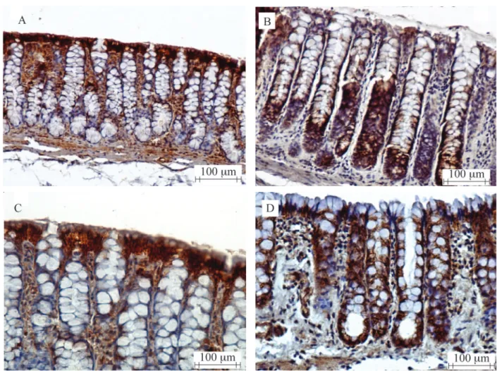 Figure 6 shows, in median, the intensity of the  variation of β-catenin  protein  expression  in  the   api-cal regions of the colonic mucosal crypts in animals  of control and experiment groups (segments with and  without fecal stream) in different times 