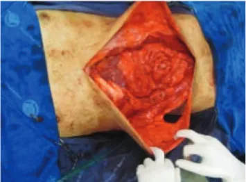 Figure 2. Perioperative and reconstruction of the seventh postoperative day.
