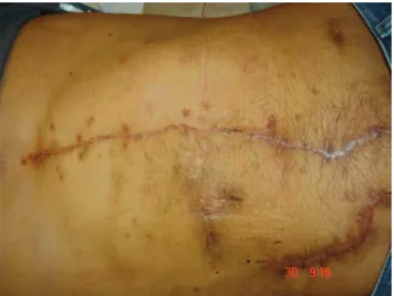 Figure 3. Third postoperative month.