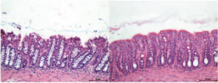 Fig. 2A shows the segment obtained from colon irrigated  with 0.9% saline for four weeks, while Fig