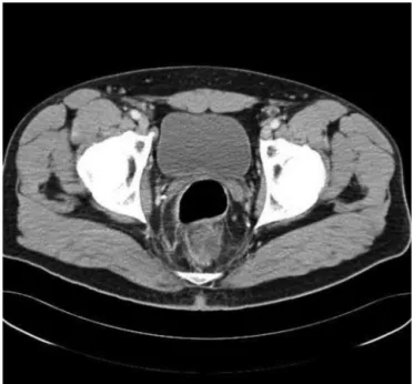 Fig. 1 – Heterogeneous hypodense image in the