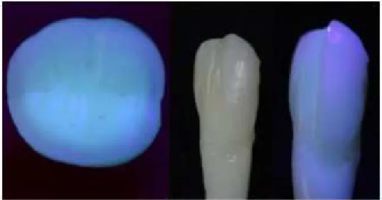Figura 2. Diferença de fluorescência entre o esmalte e a dentina (Adaptado de Soares P.V 2017) 