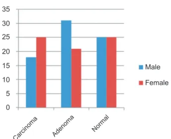 Fig. 2 – Distribution by gender of subjects according to the  group: adenoma, carcinoma and non-neoplastic colorectal  tissue.9080706050403020100