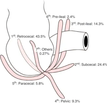 Fig. 1 – Positions of the vermiform appendix.