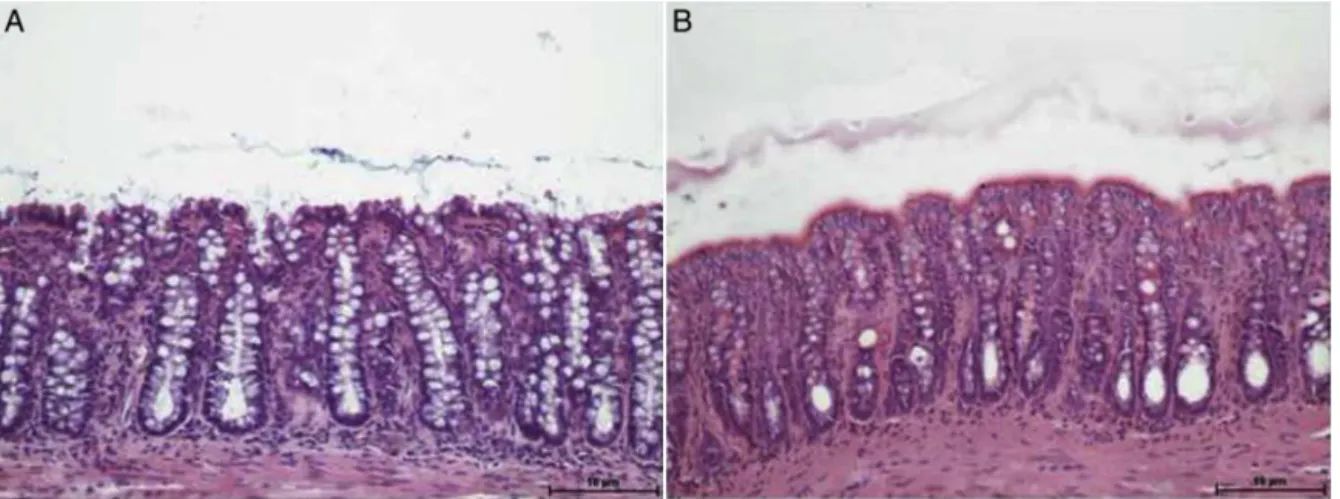 Fig. 2A shows colonic epithelium excluded from bowel tran- tran-sit, submitted to intervention with 0.9% saline for 4 weeks, while Fig