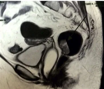 Fig. 6 – Surgical specimen.