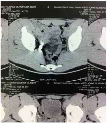 Fig. 1 – Computed tomography.