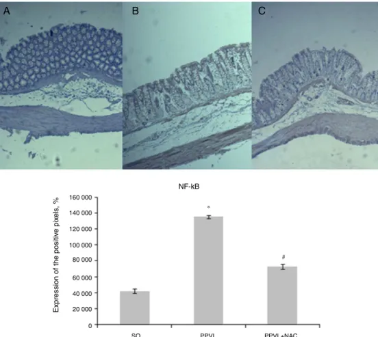 Fig. 2 – Immunohistochemistry of NF-kB. Effects of partial portal vein ligation (PPVL) and N-acetylcysteine (NAC) administration on NF-kB