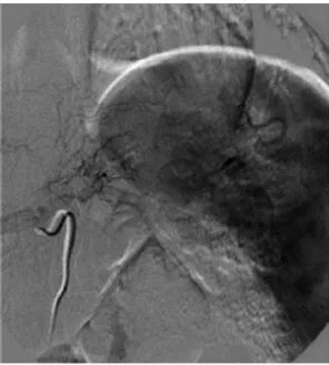 Fig. 6 – MFV in intermediate portion of the rectum.