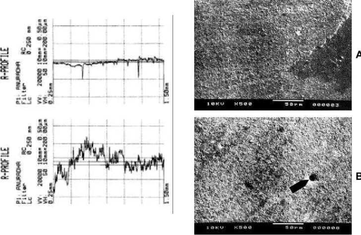 FIGURE 3- Roughness and microscopic evaluation of Variolink II (Vivadent) resin cement before (a) and after (b) brushing simulation