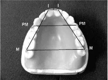 FIGURE 1- Transverse and anteroposterior teeth distances