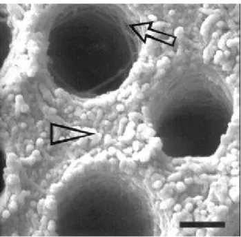 FIGURE 4- Surface view of old dentin (50 years old) etched with 36% phosphoric acid for 15 seconds