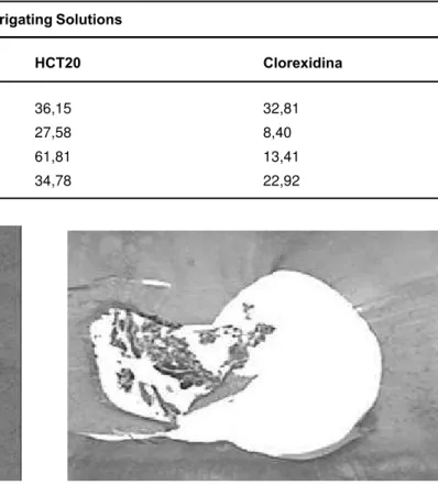 TABLE 1. Percentage of transversal area of the root canal containing debris