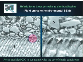 FIGURE 2 - Classification of contemporary adhesives into 3-step total etch, 2-step total-etch, 2-step self-etch and the single-step self-etch systems