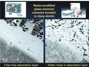 FIGURE 19 - SEM and TEM micrographs showing the presence of solid spherical bodies within the matrices of resin-modified glass-ionomer cements that were fractured close to the bonded moist dentin