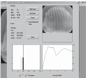 FIGURE 1 - Image showing Bone Linear Density analysis by Digora System determining the line over the fracture stubs (arrow), showing the minimum (78.00), maximum (102.00), and the mean (96.80) density profiles for this image set