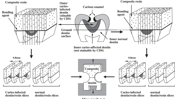 FIGURE 3 - TEM of the interface of ABF to sound dentin. A thin hybrid layer (H) and a resin tag (T) are seen